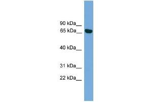 WB Suggested Anti-PRKCI Antibody Titration: 0. (PKC iota anticorps  (Middle Region))