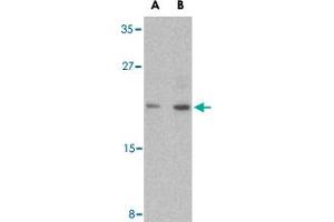 Western blot analysis of CASP6 in MCF-7 cell lysate with CASP6 polyclonal antibody  at (A) 1 and (B) 2 ug/mL . (Caspase 6 anticorps  (Internal Region))