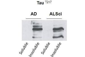 Western blot detection of insoluble phospho-Tau protein using the anti-Tau (Thr-217) antibody in samples isolated from patients with a neurodegenerative disease (Amyotropic lateral sclerosis, ALS or Alzheimer’s disease, AD (tau anticorps  (pThr217))
