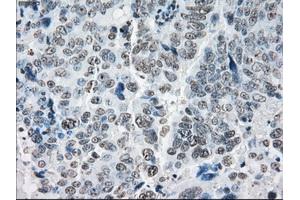 Immunohistochemical staining of paraffin-embedded colon tissue using anti-PRKYmouse monoclonal antibody. (PRKY anticorps)