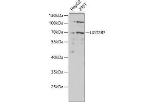 Western blot analysis of extracts of various cell lines, using UGT2B7 antibody (ABIN6132908, ABIN6149903, ABIN6149904 and ABIN6218790) at 1:1000 dilution. (UGT2B7 anticorps  (AA 25-351))