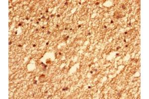 Immunohistochemistry of paraffin-embedded human brain tissue using ABIN7147383 at dilution of 1:100 (CEP126 anticorps  (AA 559-670))