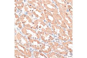 Immunohistochemistry of paraffin-embedded human stomach using HMG antibody (635) at dilution of 1:100 (40x lens). (HMGA1 anticorps  (AA 1-100))