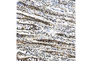 IHC analysis of PTBP1 using anti-PTBP1 antibody (ABIN7599450). (PTBP1 anticorps  (AA 1-504))