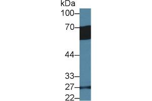Detection of GP6 in Human Serum using Polyclonal Antibody to Glycoprotein VI (GP6) (GP6 anticorps  (AA 86-231))