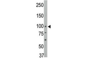 Western Blotting (WB) image for anti-Protein tyrosine Phosphatase, Non-Receptor Type 3 (PTPN3) antibody (ABIN3003754) (PTPN3 anticorps)