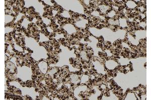 ABIN6277720 at 1/100 staining Rat lung tissue by IHC-P. (TXNIP anticorps  (Internal Region))