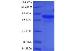 Small Nuclear Ribonucleoprotein D2 Polypeptide 16.