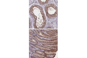 Immunohistochemical staining of human stomach with CORO2A polyclonal antibody  shows cytoplasmic and moderate membranous positivity in glandular cells. (CORO2A anticorps)