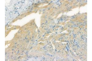 ABIN6263831 and ABIN6272710 at 1/100 staining human normal colon tissue by IHC-P.