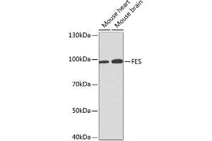 Western blot analysis of extracts of various cell lines using FES Polyclonal Antibody at dilution of 1:1000. (FES anticorps)