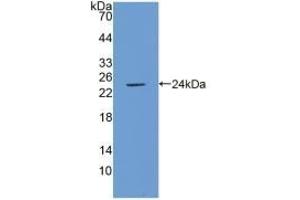 Detection of Recombinant ICAM1, Porcine using Polyclonal Antibody to Intercellular Adhesion Molecule 1 (ICAM1) (ICAM1 anticorps  (AA 27-209))