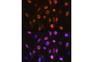 Immunofluorescence analysis of NIH-3T3 cells using B Rabbit mAb (ABIN7265377) at dilution of 1:100 (40x lens).