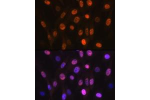 Immunofluorescence analysis of NIH-3T3 cells using B Rabbit mAb (ABIN7265377) at dilution of 1:100 (40x lens). (ANP32B anticorps)