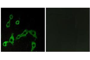Immunofluorescence analysis of LOVO cells, using ADRA2A antibody. (ADRA2A anticorps  (Internal Region))