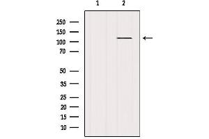 Western blot analysis of extracts from Mouse brain, using Androgen Receptor Antibody. (Androgen Receptor anticorps)