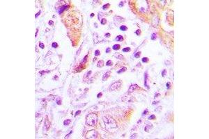 Immunohistochemistry (IHC) image for anti-TSC22 Domain Family, Member 3 (TSC22D3) antibody (ABIN7308446)