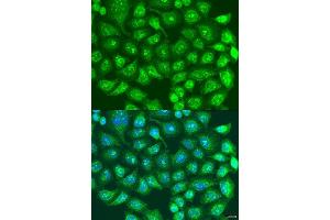 Immunofluorescence analysis of U2OS cells using SPICE1 antibody. (SPICE1 anticorps  (AA 1-220))