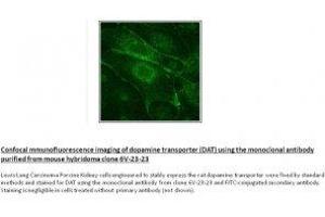 Image no. 1 for anti-Solute Carrier Family 6 (Neurotransmitter Transporter, Dopamine), Member 3 (SLC6A3) (N-Term) antibody (ABIN1169684)
