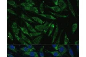 Immunofluorescence analysis of L929 cells using PITRM1 Polyclonal Antibody at dilution of 1:100 (40x lens). (PITRM1 anticorps)