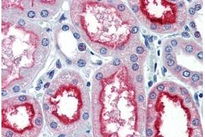 Human Kidney (formalin-fixed, paraffin-embedded) stained with ACE antibody ABIN337280 at 10 ug/ml followed by biotinylated anti-mouse IgG secondary antibody ABIN481714, alkaline phosphatase-streptavidin and chromogen.