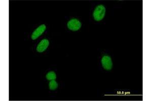 Immunofluorescence of purified MaxPab antibody to ZNF435 on HeLa cell. (ZSCAN16 anticorps  (AA 1-348))