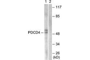 Western blot analysis of extracts from 293 cells, using PDCD4 (Ab-457) Antibody. (PDCD4 anticorps  (AA 420-469))