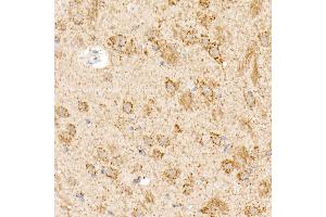 Immunohistochemistry of paraffin-embedded rat brain using OGDH Rabbit pAb (ABIN6131414, ABIN6145003, ABIN6145005 and ABIN6222018) at dilution of 1:25 (40x lens).