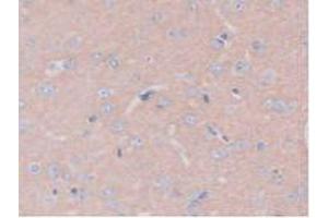 IHC-P analysis of Rat Brain Tissue, with DAB staining. (PTPRB anticorps  (AA 1041-1310))