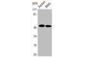 Western Blot analysis of Jurkat K562 cells using DR4 Polyclonal Antibody