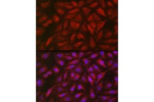 Immunofluorescence analysis of U2OS cells using SOCS3 Rabbit pAb (ABIN3015316, ABIN3015317, ABIN5663764 and ABIN6213984) at dilution of 1:50 (40x lens). (SOCS3 anticorps  (C-Term))