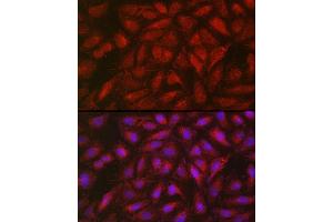 Immunofluorescence analysis of U2OS cells using SOCS3 Rabbit pAb (ABIN3015316, ABIN3015317, ABIN5663764 and ABIN6213984) at dilution of 1:50 (40x lens). (SOCS3 anticorps  (C-Term))