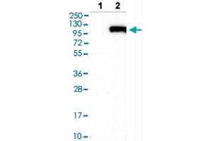 Western blot analysis of Lane 1: Negative control (vector only transfected HEK293T lysate), Lane 2: Over-expression lysate (Co-expressed with a C-terminal myc-DDK tag (~3. (Fibulin 1 anticorps  (AA 266-402))