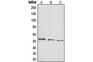 Western blot analysis of Parkin expression in HepG2 (A), SHSY5Y (B), SW480 (C) whole cell lysates. (Parkin anticorps  (N-Term))