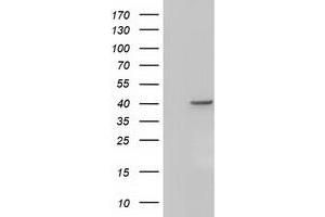 Western Blotting (WB) image for anti-Acetyl-CoA Acetyltransferase 2 (ACAT2) antibody (ABIN1496405) (ACAT2 anticorps)
