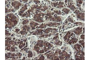 Image no. 10 for anti-Ubiquitin-Conjugating Enzyme E2, J1, U (UBE2J1) antibody (ABIN1501638)