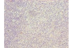 Immunohistochemistry of paraffin-embedded human tonsil tissue using ABIN7156460 at dilution of 1:100 (ITGAL anticorps  (AA 201-500))