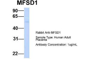 Host:  Rabbit  Target Name:  MFSD1  Sample Type:  Human Adult Placenta  Antibody Dilution:  1. (MFSD1 anticorps  (Middle Region))