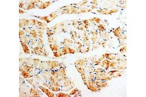 IHC-P: PMVK antibody testing of rat skeletal muscle tissue (PMVK anticorps  (Middle Region))