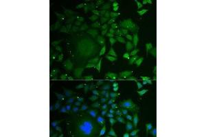 Immunofluorescence analysis of U2OS cells using C1D Polyclonal Antibody (C1D anticorps)