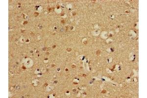 Immunohistochemistry of paraffin-embedded human brain tissue using ABIN7146829 at dilution of 1:100 (CPT1C anticorps  (AA 699-803))