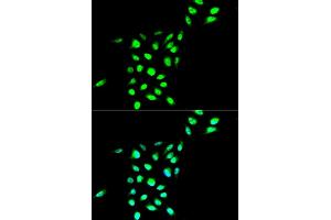 Immunofluorescence analysis of A549 cell using VCP antibody. (VCP anticorps)