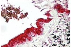 Immunohistochemical staining (Formalin-fixed paraffin-embedded sections) of human lung with MXI1 polyclonal antibody  at 4-8 ug/mL working concentration. (MXI1 anticorps  (Internal Region))