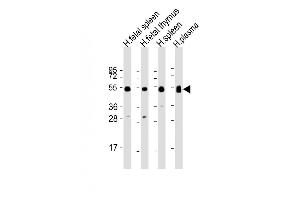 All lanes : Anti-IGHG1 Antibody (Center) at 1:2000 dilution Lane 1: human fetal spleen lysate Lane 2: human fetal thymus lysate Lane 3: human spleen lysate Lane 4: human plasma lysate Lysates/proteins at 20 μg per lane.
