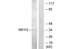 Western Blotting (WB) image for anti-Nuclear Receptor Subfamily 1, Group I, Member 3 (NR1I3) (Internal Region) antibody (ABIN1849606) (NR1I3 anticorps  (Internal Region))