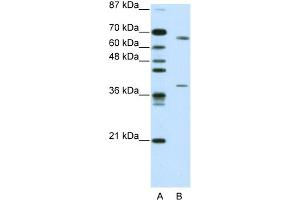 WB Suggested Antibody Titration:  0. (GRHL3 anticorps  (C-Term))