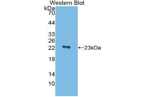 Detection of Recombinant PGLYRP1, Mouse using Polyclonal Antibody to Peptidoglycan Recognition Protein 1 (PGLYRP1)