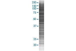 KIF2C transfected lysate. (KIF2C 293T Cell Transient Overexpression Lysate(Denatured))