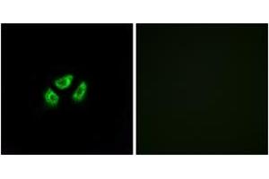Immunofluorescence analysis of A549 cells, using SCN7A Antibody. (SCN7A anticorps  (AA 771-820))