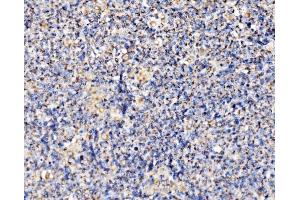 IHC analysis of PMPCA/INPP5 using anti-PMPCA/INPP5 antibody (ABIN7602722). (PMPCA anticorps  (AA 99-525))